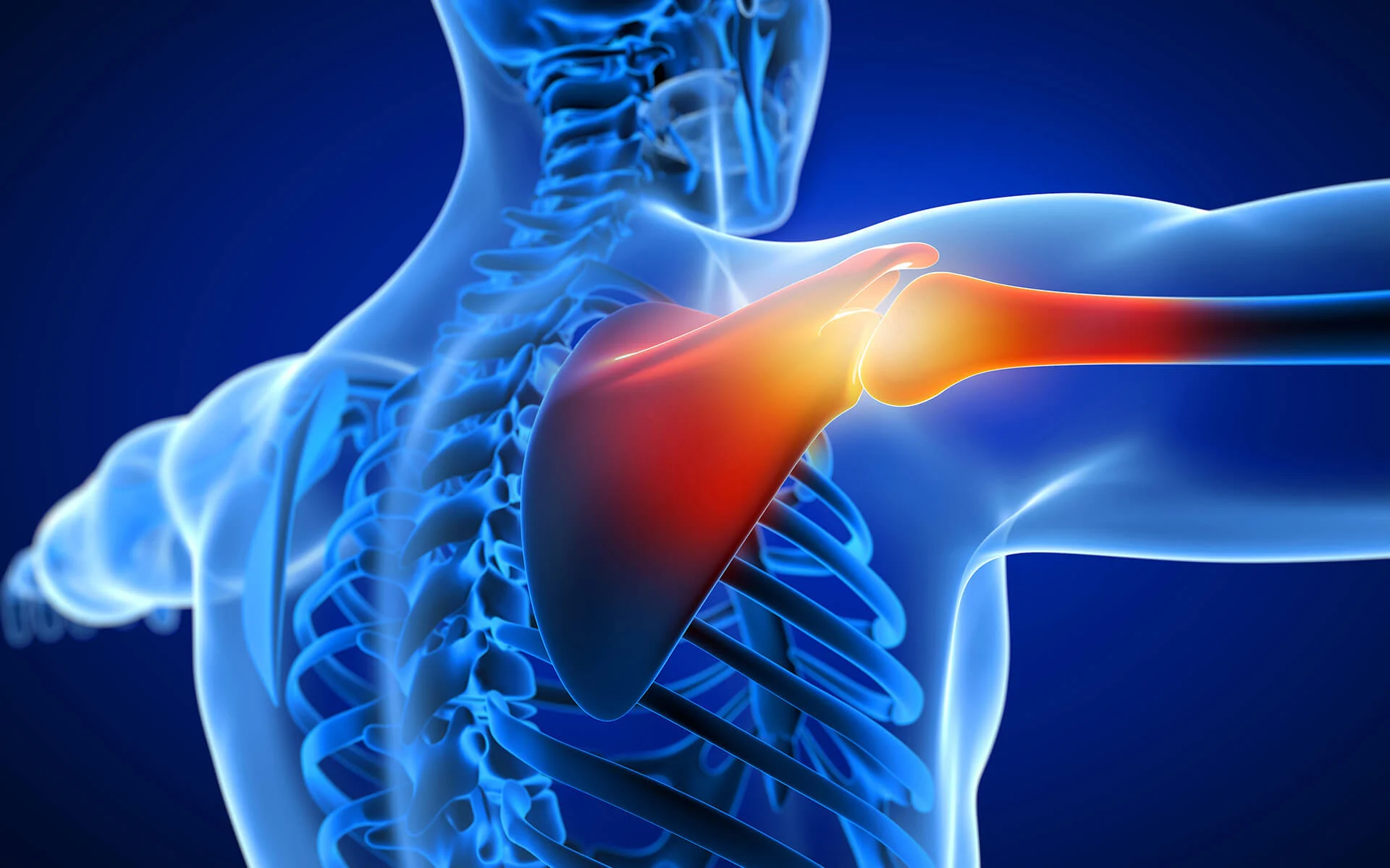 Brachial Plexus Injury Treatment