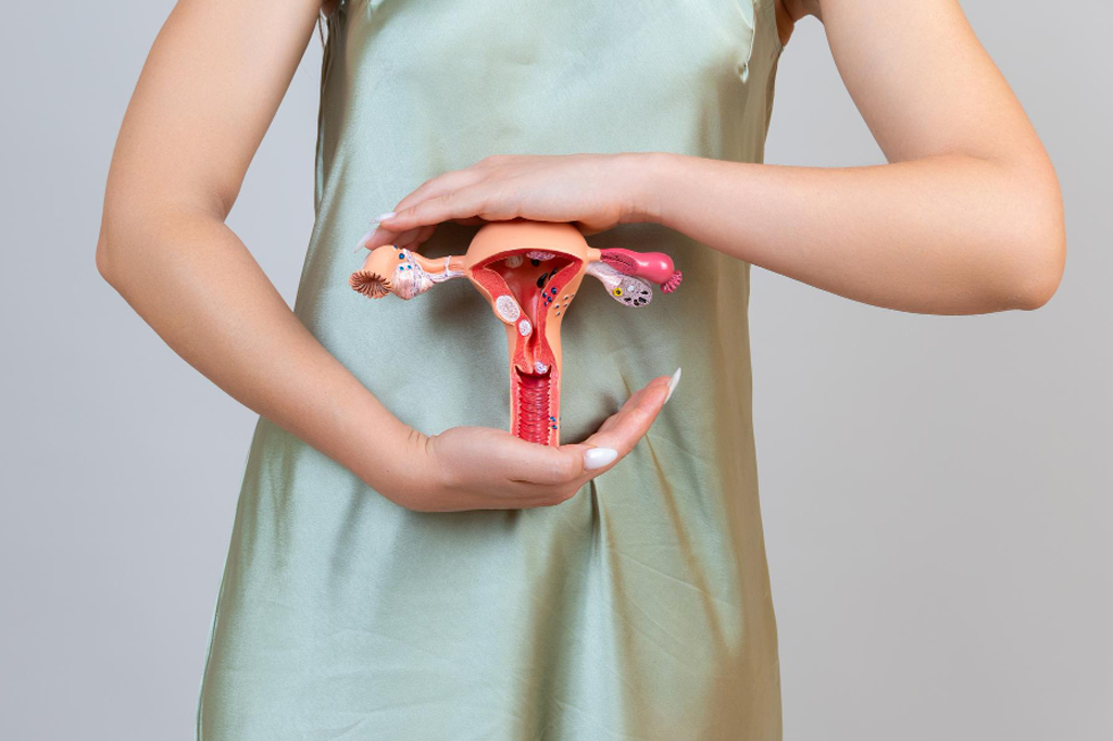 Uterine Fibroids