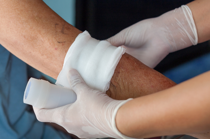 Wounds and Ulcer Management