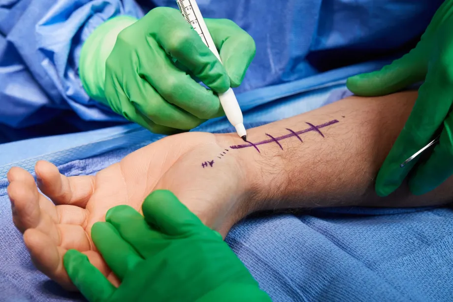 Hand Surgery