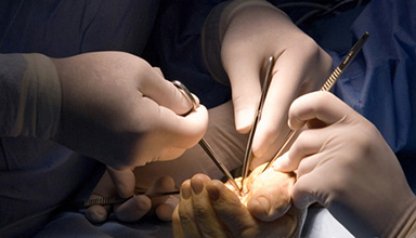 Peripheral Nerve Injury Repair