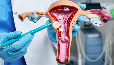 Adenomyosis