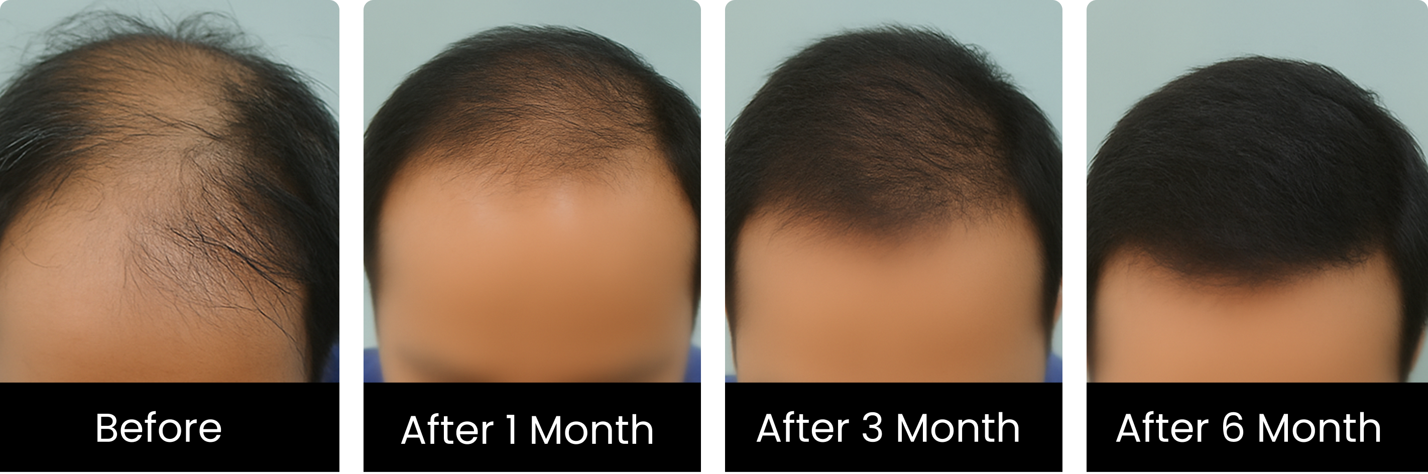 Hair Treatment