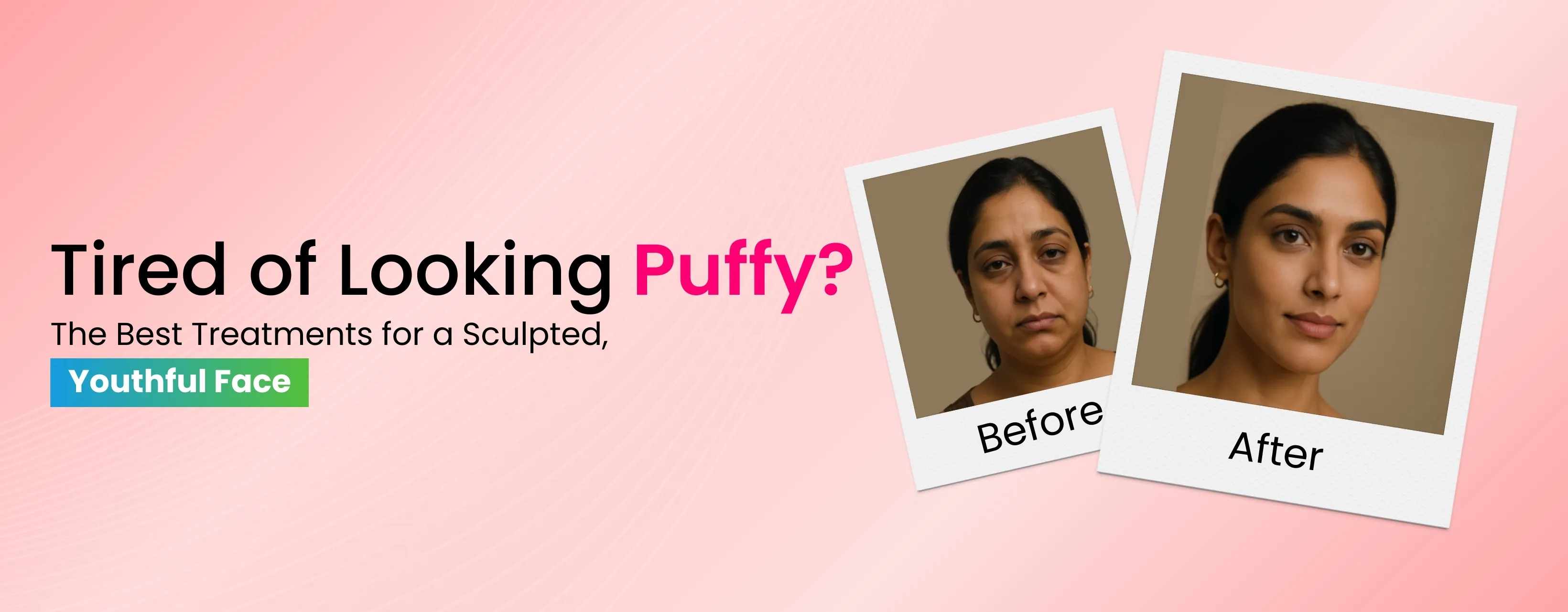 Tired of Looking Puffy? The Best Treatments for a Sculpted, Youthful Face