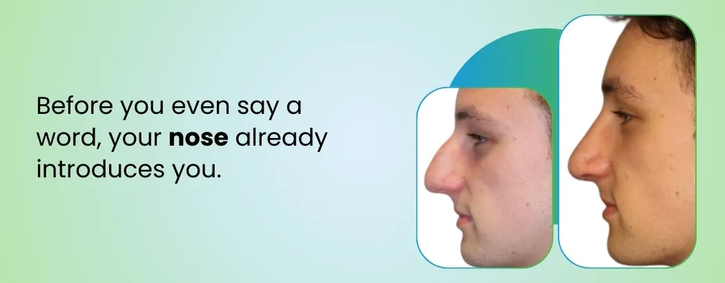 Before you even say a word, your nose already introduces you.