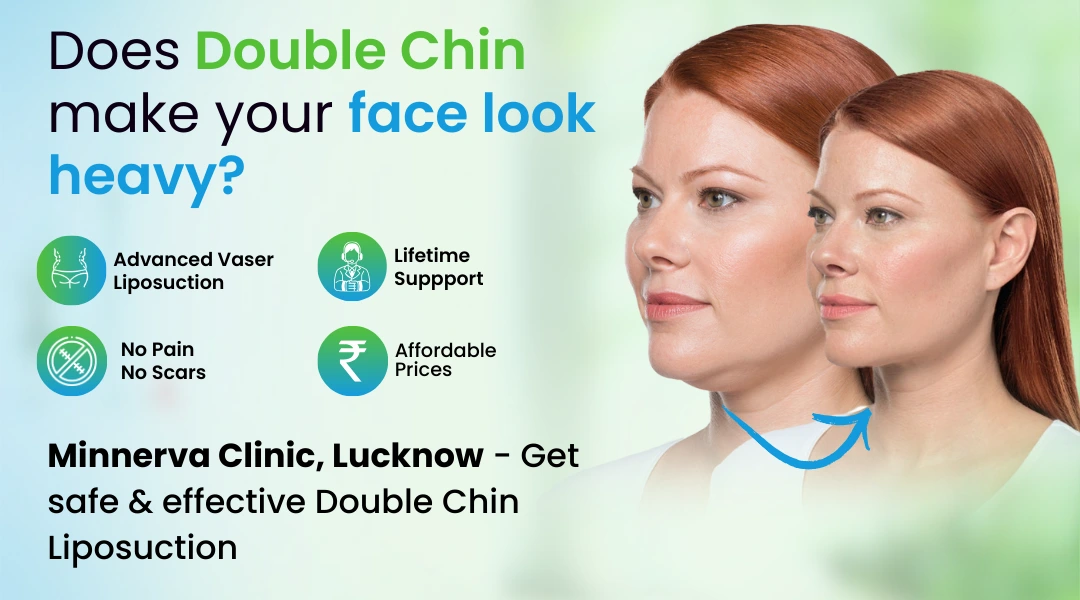 Double Chin Liposuction