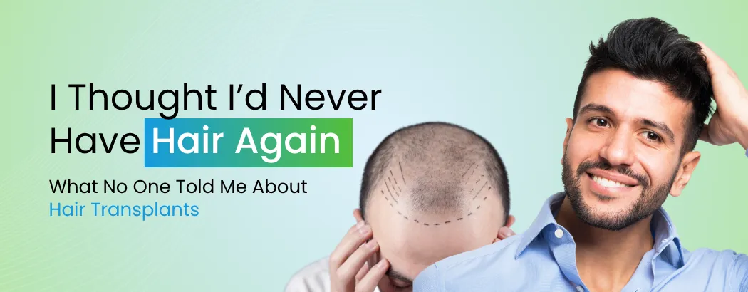 I Thought I’d Never Have Hair Again — What No One Told Me About Hair Transplants