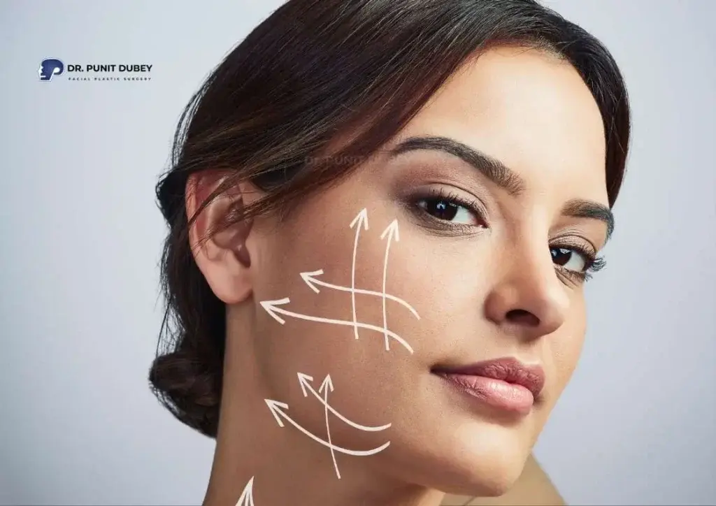 Thread Lift