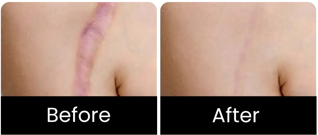 Patient Image