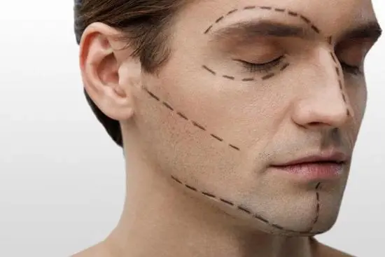 Jawline Contouring