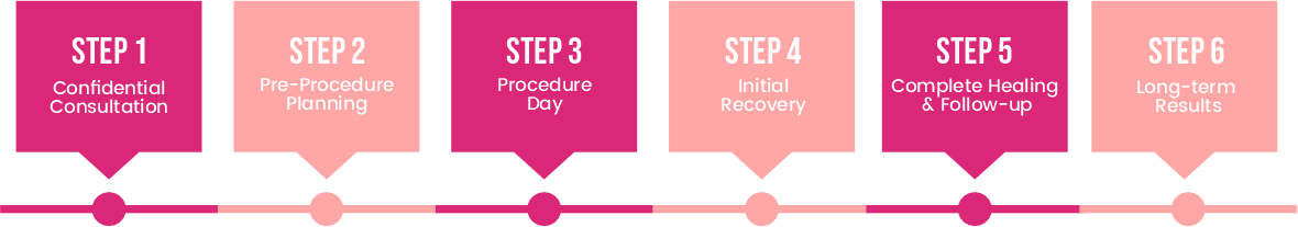 PCOS Treatment Steps