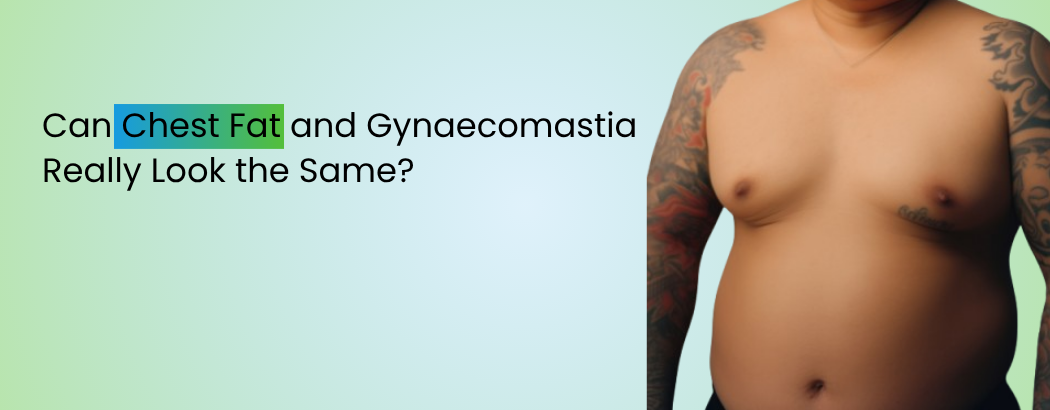 Can Chest Fat and Gynaecomastia Really Look the Same?
