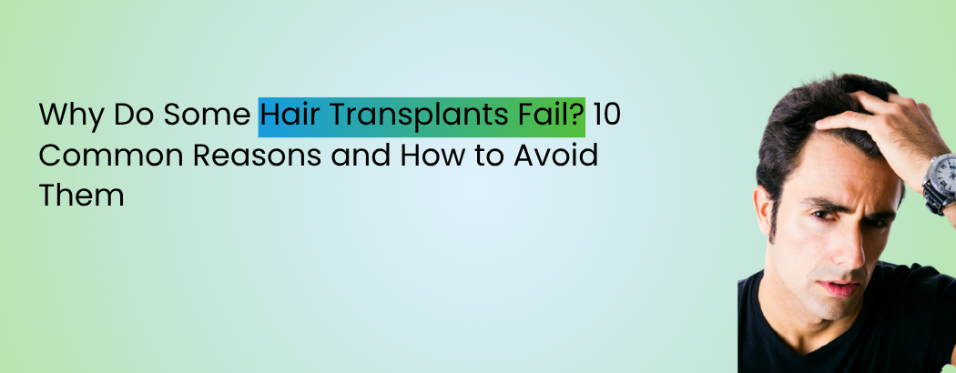 Why Do Some Hair Transplants Fail? 10 Common Reasons and How to Avoid Them