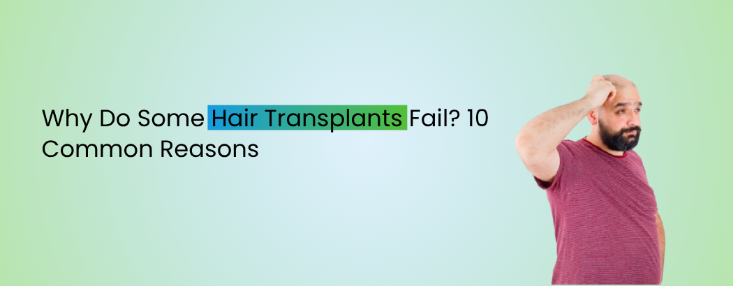 Why Do Some Hair Transplants Fail? 10 Common Reasons
